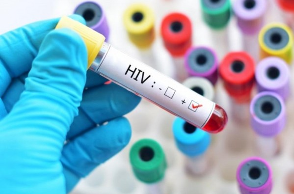 Thời gian thông báo kết quả xét nghiệm HIV dương tính